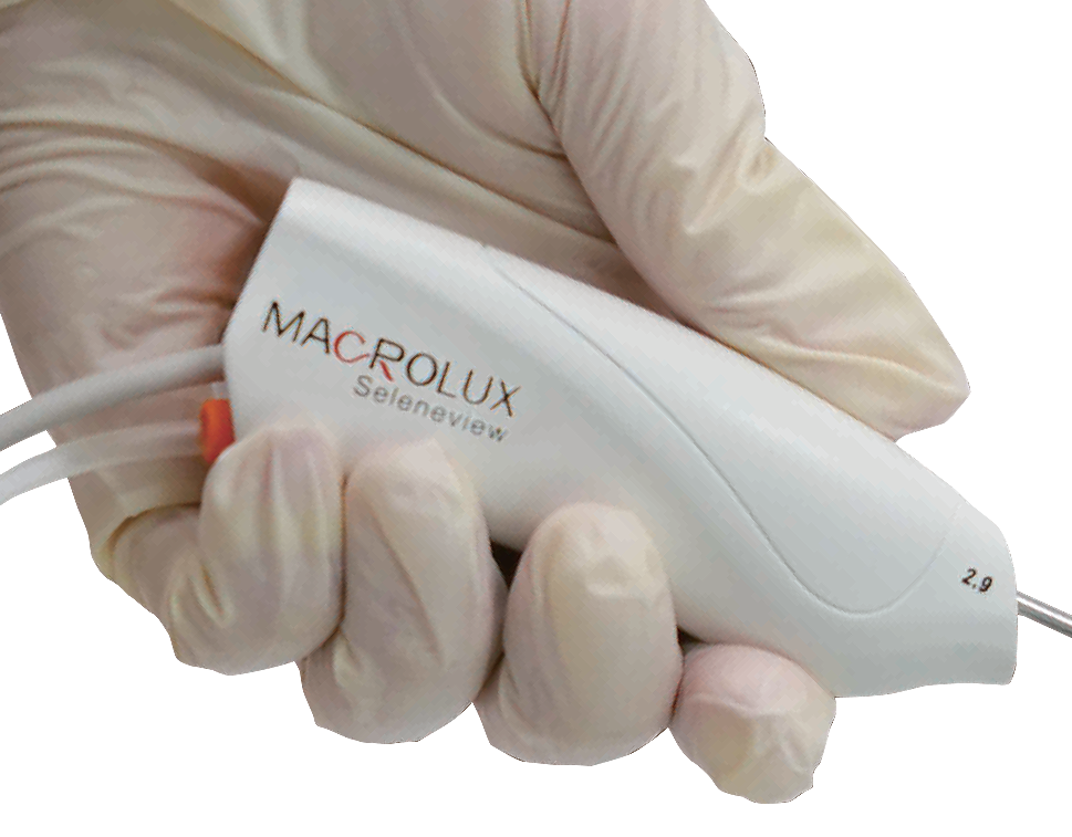 Macrolux haandHandskeClose