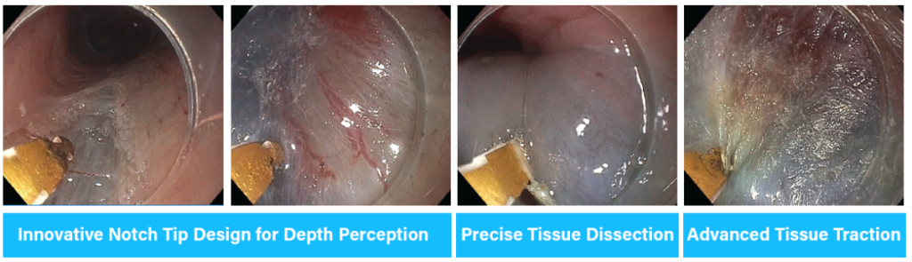 notch clinical stills with blank annotations en.ddb256d1baa44459d9ae3adc801517e4