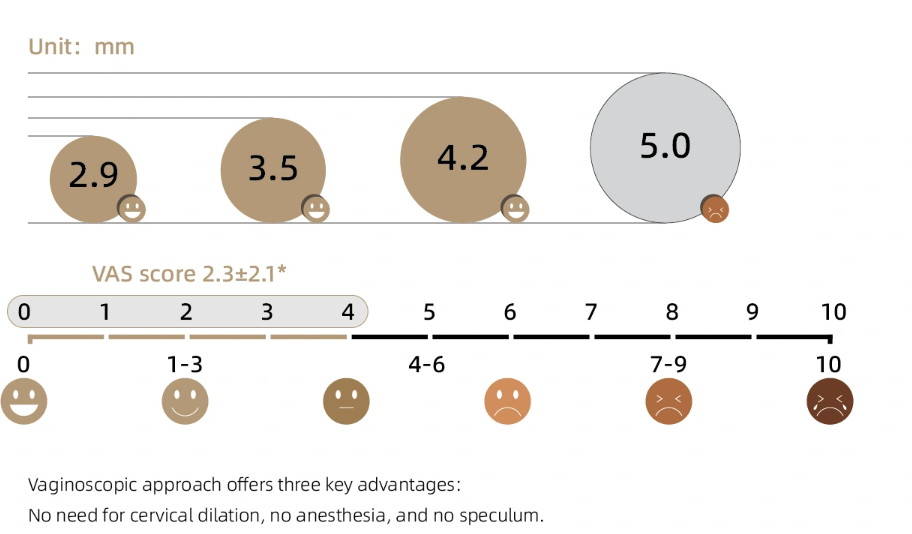 Outer diameter compared: Macrolux 2.9, 3.5 and 4.2 mm against a conventional 5.0 mm hysteroscope, drawn at true relative scale, with the reported VAS pain score of 2.3 plus or minus 2.1 marked on a 0 to 10 scale.
