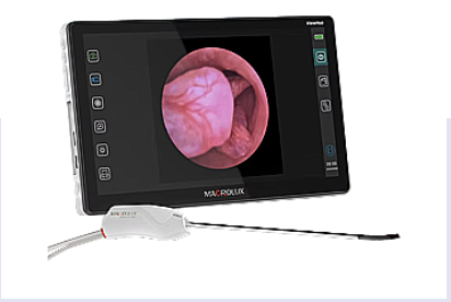 Macrolux SeleneView hysteroscope connected to the ViewHub video processor.