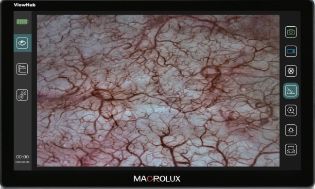 Macrolux ViewHub S13 video processor.